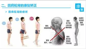 矫正驼背视频,跟随专业视频，轻松改善体态